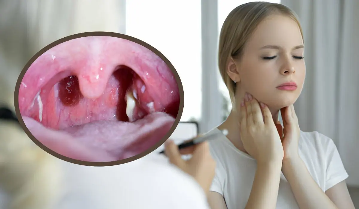 White Spots On Tonsils Causes Symptoms Treatments Options   White Spots On Tonsils.webp